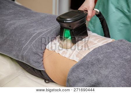 Woman Getting Cryolipolysis Fat Treatment Procedure In Professional Cosmetic Cabinet Or Spa Center