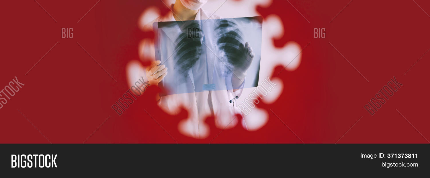 Banner. Radiologist Image & Photo (Free Trial) | Bigstock