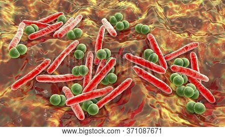 Respiratory Pathogens, Bacteria Mycobacterium Tuberculosis And Streptococcus Pneumoniae, 3d Illustra