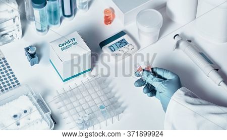 Novel Coronavirus 2019 Ncov Rt-pcr Diagnostics Kit. It Contains Reagents, Primers And Control Sample