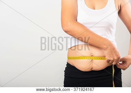 Asian Mother Woman Use Section Postpartum Scar Measuring Waist Stretch Mark Loose Lower Abdomen Skin