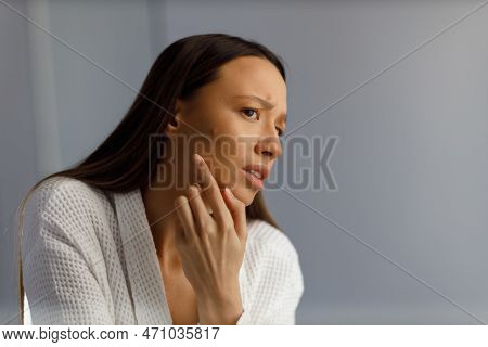 Attractive Upset Young Woman In White Bathrobe Examines Pimples On Her Face. Problematic Skin On The