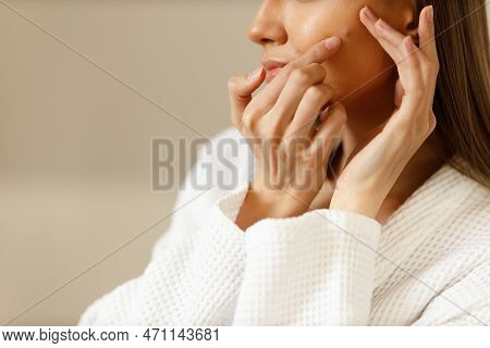Attractive Upset Young Woman In White Bathrobe Examines Pimples On Her Face Close Up. Problematic Sk