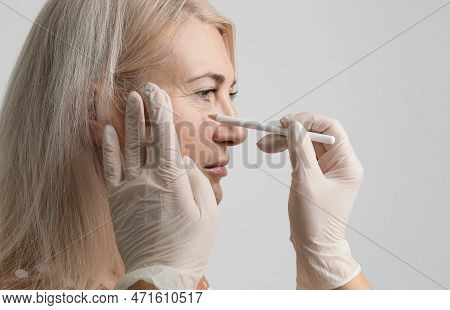 Thread Facelift, Concept Of Lifting Skin. Procedure Facial Contouring Using Mesothreads. A Beauticia