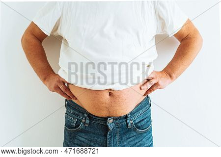 Man In Denim Fat Belly. Concept Of Overweight, Big Belly, Trousers Do Not Fasten. Caucasoid Man With