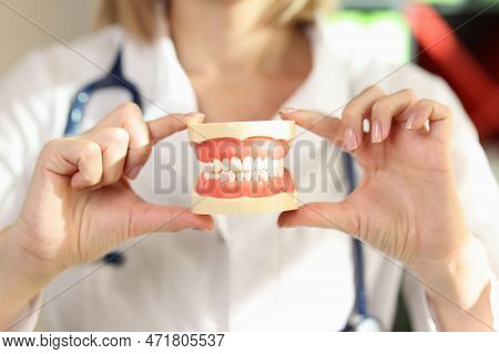 Close-up Of Doctor Stomatologist Holding Jowl Model In Hands. Teeth Orthodontic Dental Model Or Huma