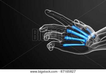 3D Render Medical Illustration Of The Metacarpal Bone