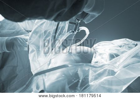 Knee Surgery Hospital Operation