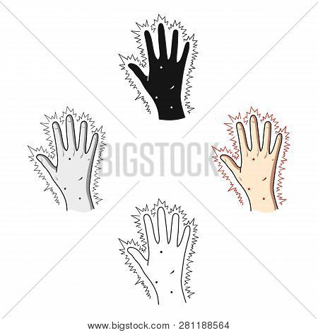 The Arm Of The Patient With Diabetes.hand With Eczema From Diabetes.diabetes Single Icon In Cartoon 
