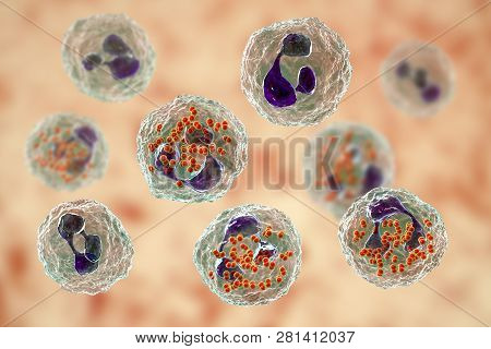 Bacteria Neisseria Gonorrhoeae Inside Neutrophils, Gonoccoccus, Diplococci That Cause Sexually Trans