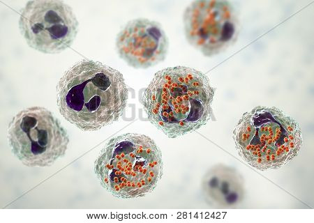 Bacteria Neisseria Gonorrhoeae Inside Neutrophils, Gonoccoccus, Diplococci That Cause Sexually Trans