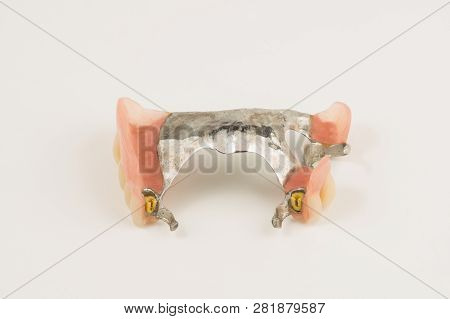 Bugel Remove Dentures With Attachments On White Background