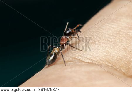 Male Ant Mimicking Jumping Spider On Hand
