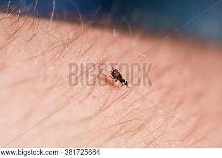 A Small Black Insect Sits On A Hand Close-up. Insect In The Palm Of Your Hand. Close-up
