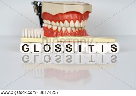 Medical, Dental Concept. The Text Is Written On The Cubes - Glossitis. In The Background Is A Model 