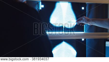 Doctor Examines Mammogram Snapshot Of Breast Of Female Patient On The Monitors With Magnifying Glass