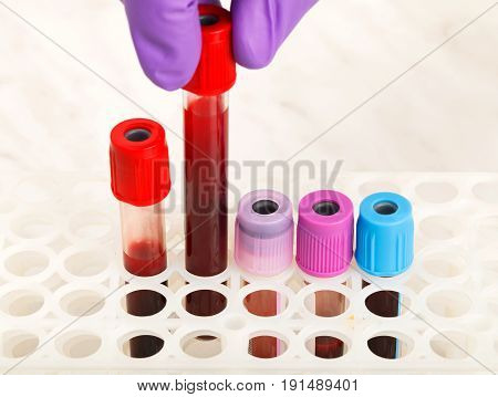 Doctor holding blood sample ampoule in hand