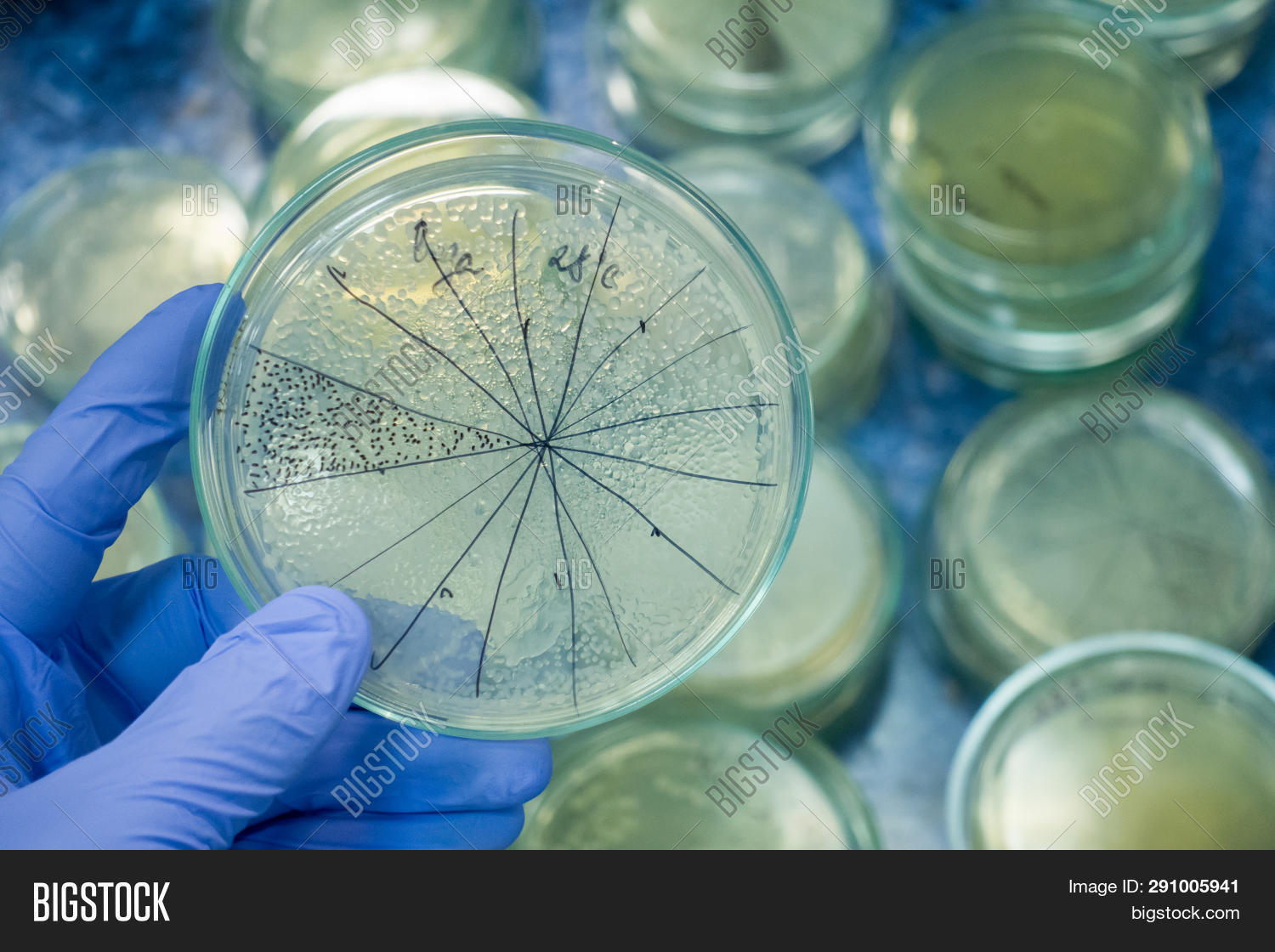 Petri Dish Highlighted Image & Photo (Free Trial) Bigstock