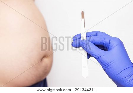 Doctor Holds A Scalpel On The Background Of A Fat And Fat Male Abdomen, The Concept Of The Operation