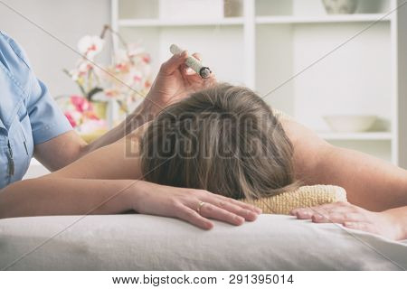 Alternative medicine therapist doing moxa treatment on her client