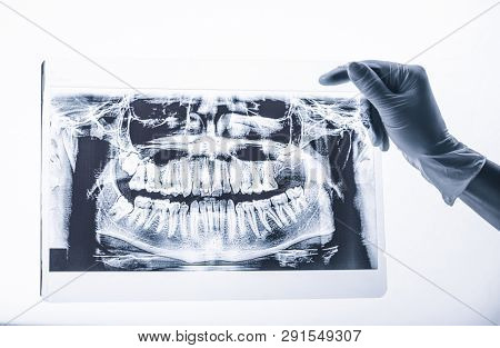 hand in white glove holding mouth dental x-ray on white background