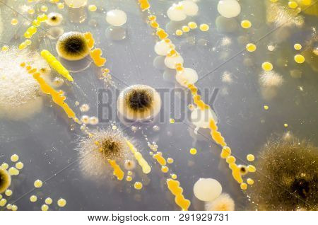 Colonies Of Different Bacteria And Mold Fungi From Air Grown On Petri Dish. Microbiology Background