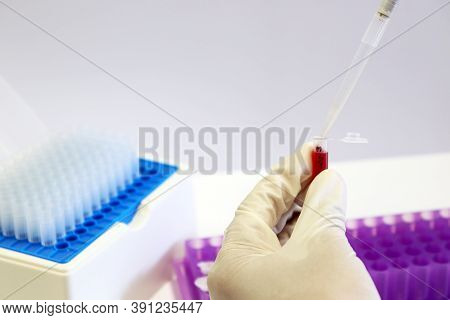 Scientist Transfers Blood Sample Into Micro Centrifuge Tubes By Using Micropipette Handle In Hand, W