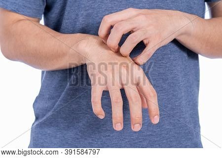 Male Scratching His Hand Isolated White Background. Medical, Healthcare For Advertising Concept.