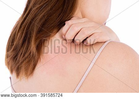 Female Scratching Her Back Isolated White Background. Medical, Healthcare For Advertising Concept.
