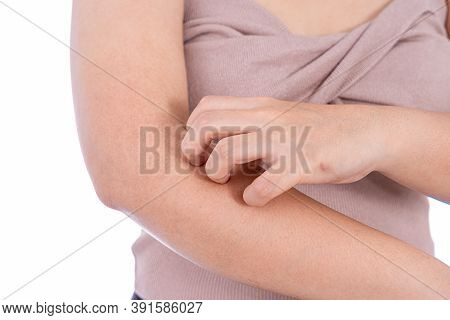 Female Scratching Her Arm Isolated White Background. Medical, Healthcare For Advertising Concept.