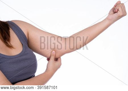 Woman Holding Excessive Fat Arm Isolated White Background. Woman Pinching Arm Fat Flabby Skin. Weigh