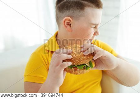 A Boy With Metabolic Disorders. Child With The Problem Of Childhood Obesity. Overweight Obese Fat Bo
