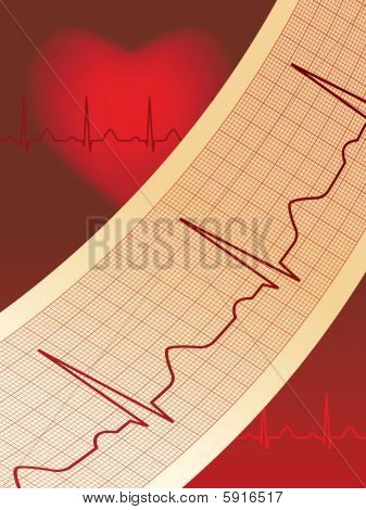 Elektrokardiogram