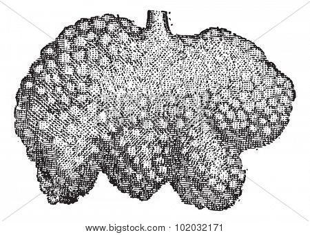 Intestine, Brunner's glands or duodenal glands, vintage engraved illustration. Dictionary of words and things - Larive and Fleury - 1895.