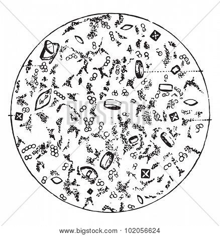 Some deposits in acid fermentation of the urine, vintage engraved illustration. 