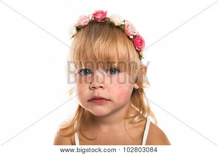 Girl With A Diathesis, Wreath  On Her Head On A White Background