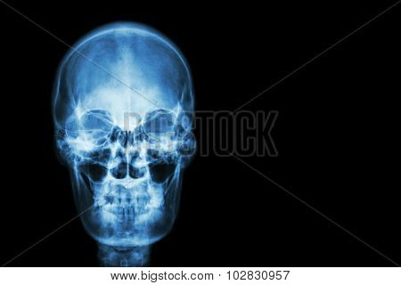 Film X-ray Skull Of Human And Blank Area At Right Side ( Medical , Science And Healthcare Concept An