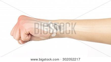 Wrist Bones Injury White Background Wrist Pain