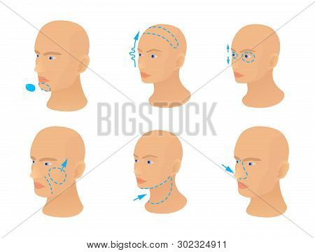 Head Operation Icon Set. Cartoon Set Of Head Operation Icons For Web Design Isolated On White Backgr