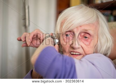 Blind,elderly Woman Listening To Her Talking Wrist Watch,england,u.k.