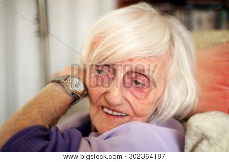 Blind,elderly Woman Listening To Her Talking Wrist Watch,england,u.k.