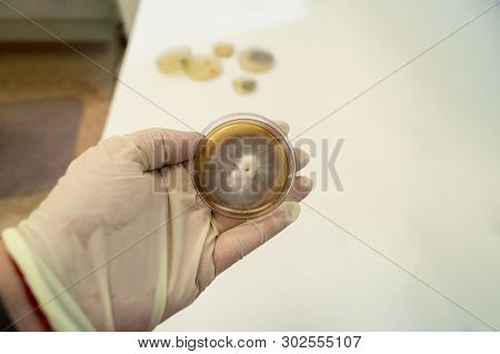 Mold Grown On A Sabouraud Agar Medium In A Petri Dish.