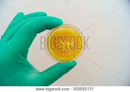 Mold Grown On A Sabouraud Agar Medium In A Petri Dish.