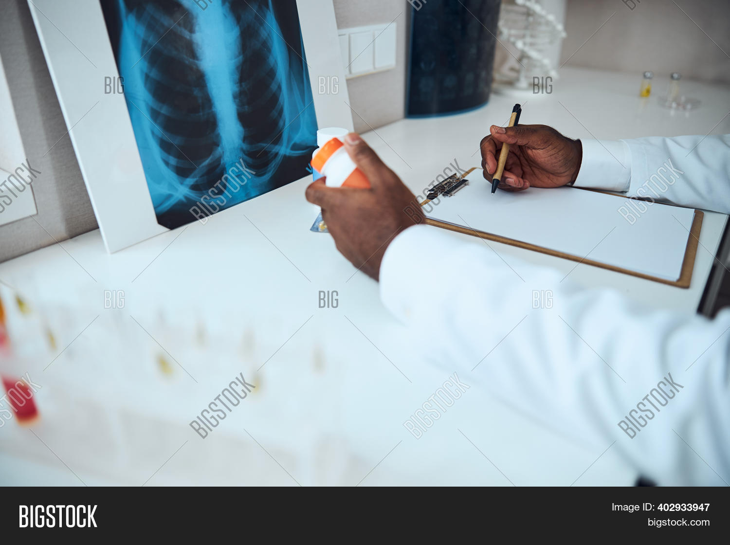 Male Front Radiograph Image & Photo (Free Trial) | Bigstock