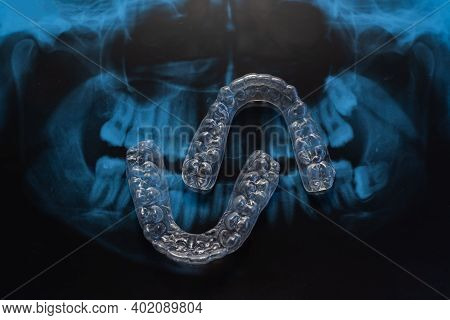 Transparent Bite Correction Trays And X-ray Of The Jaw. Orthodontist Equipment