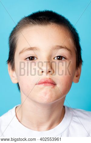 Portrait Of A Sad Boy With Mild Perioral Dermatitis On A Blue Background