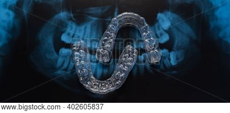 Transparent Bite Correction Trays And X-ray Of The Jaw. Orthodontist Equipment