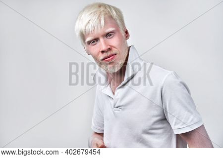 Albinism Albino Man White Skin Hair Studio Dressed T-shirt Isolated White Background. Abnormal Devia