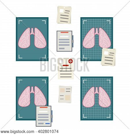 Medical Tests And Diagnosis. Problems Breathing And Lungs. Internal Human Organ. X-ray And Photo Ima