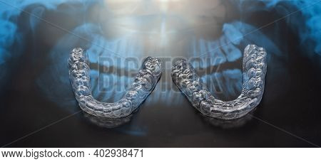 Transparent Bite Correction Trays And X-ray Of The Jaw. Orthodontist Equipment